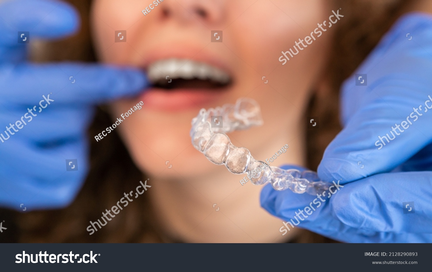 GÜLÜŞÜNÜZDEKİ DEĞİŞİMİ HIZLA FAR EDİN